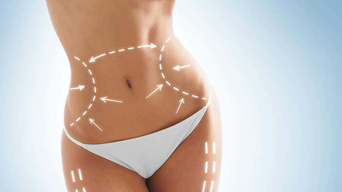 Laser Lipo with endolift